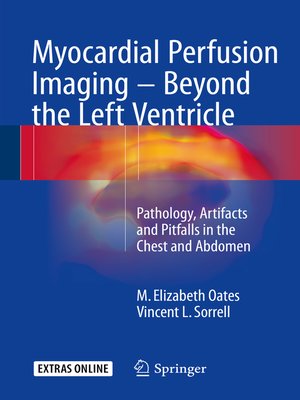 cover image of Myocardial Perfusion Imaging--Beyond the Left Ventricle